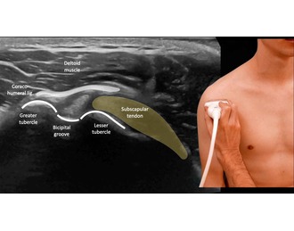 /Content/ServiceImages/biceps-holder (1) (2).jpg